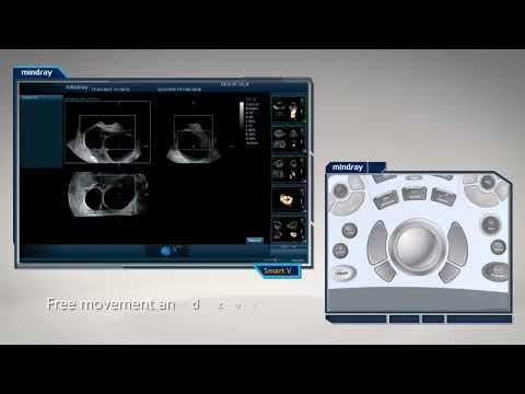 Видеообзор опции