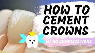 Dental Crown Delivery | 9 Tips to Make Your Crown Appointments Easier