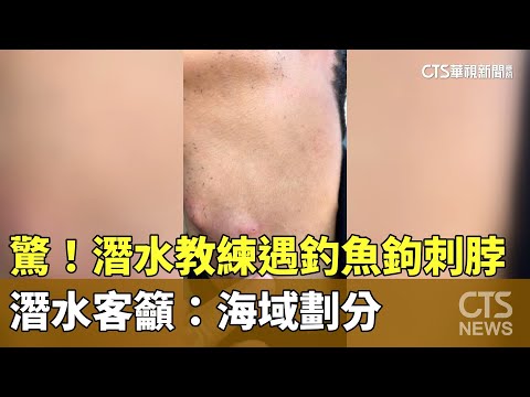 驚！　潛水教練遇釣魚鉤刺脖　潛水客籲：海域劃分