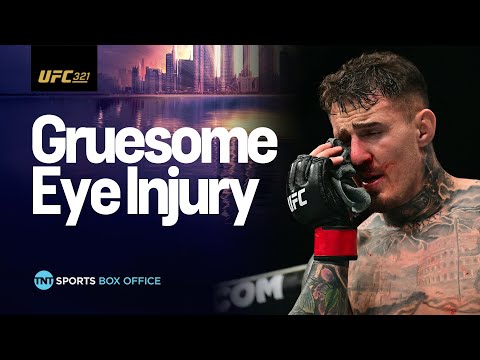EMOTIONAL SCENES! Tom Aspinall retains title after eye injury forces no contest against Gane #UFC321