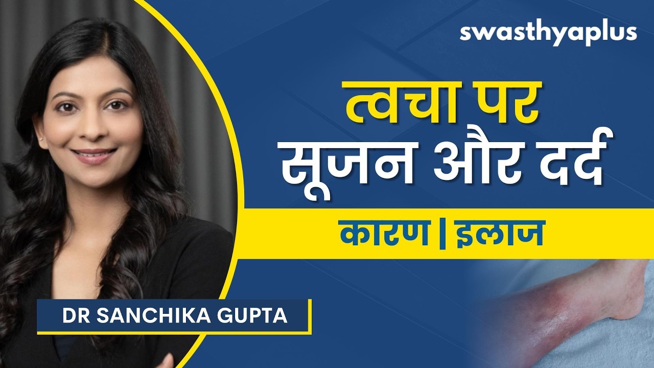 सेल्यूलाइटिस: लक्षण और इलाज | Cellulitis: Causes & Symptoms in Hindi | Treatment | Dr Sanchika
