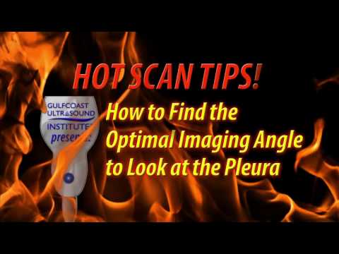 Hot Tip-How to Find the Optimal Imaging Angle to Look at the Pleura in a Pediatric Patient