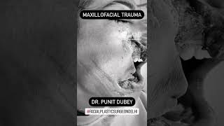 Prevent Facial Accidents | Face The Road With A Helmet | Dr. PUNIT DUBEY