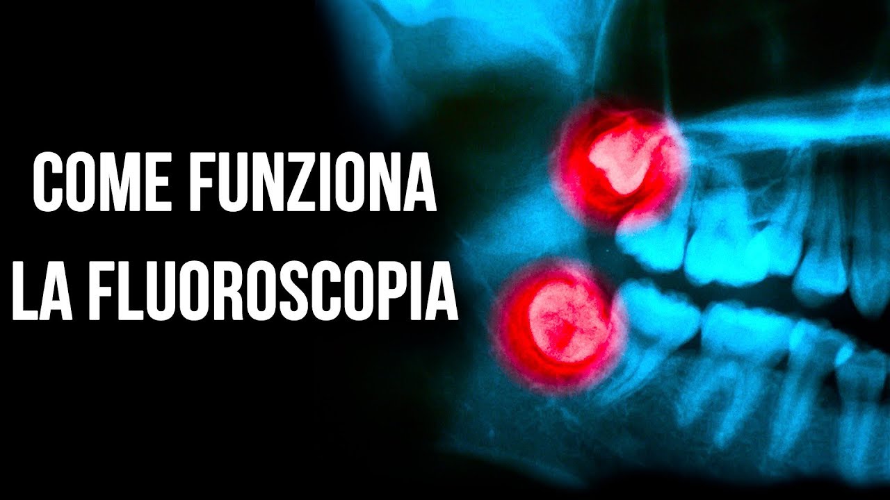 Come Funziona La Fluoroscopia A Raggi-X
