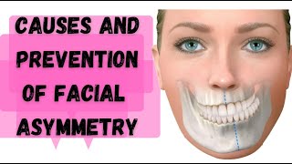 Why your face is ASYMMETRIC and how to Improve Facial ASYMMETRY?