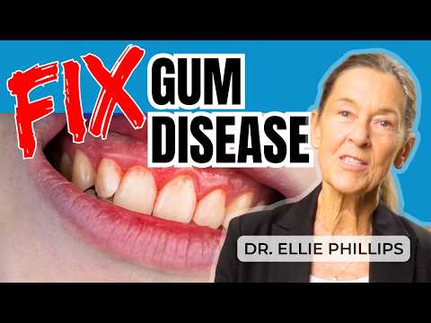 The ONE Strategy For Curing Gum Disease & Cavities