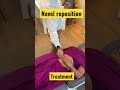 Navel Center Reposition Chiropractic Treatment