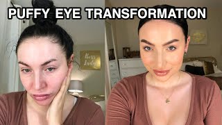 TIRED/PUFFY/CRY EYES TRANSFORMATION | Sheridan Leatherberry