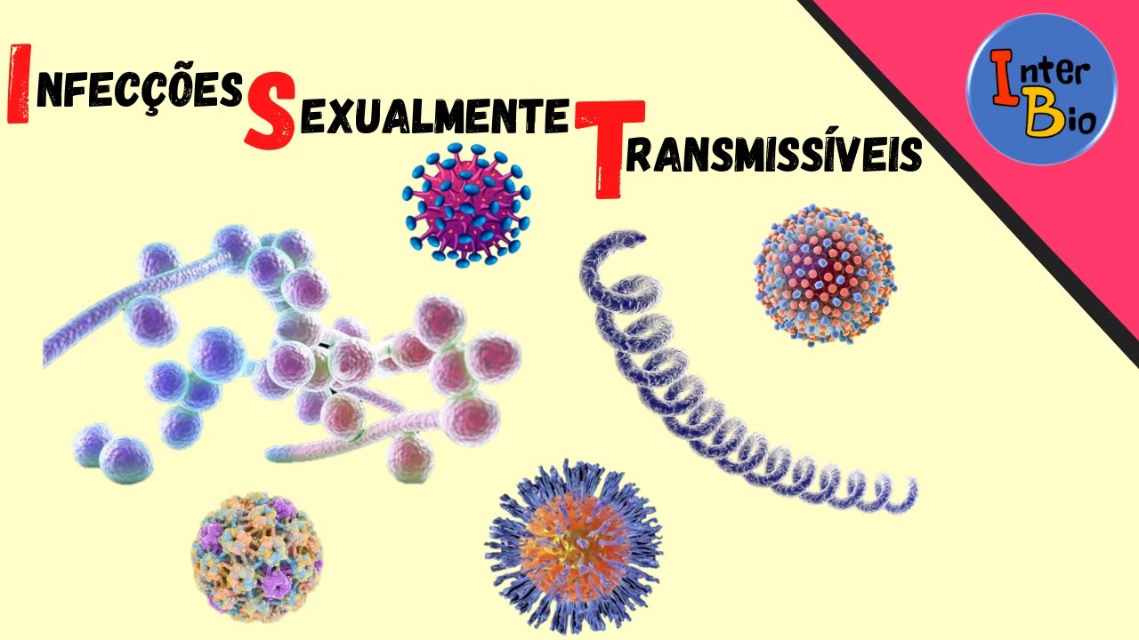 Reprodução Humana - Infecções Sexualmente Transmissíveis (IST)