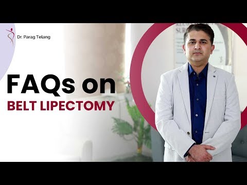 Belt Lipectomy
