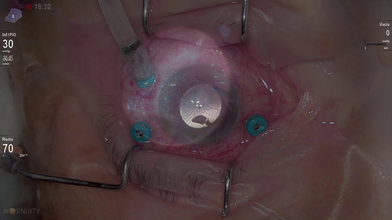 Marco Antonio Rayón Rodríguez-17