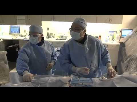 Heart Catheterization through Radial Artery