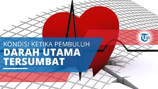 Penyakit Jantung Koroner, Penyakit Mematikan di Dunia,Terjadi ketika Pembuluh Darah Tersumbat