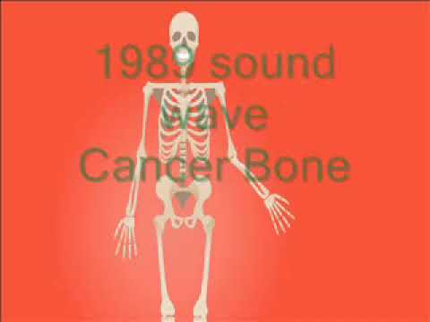 Rife Frequency | Cancer Bone | Binaural Beats | 1989 sound wave