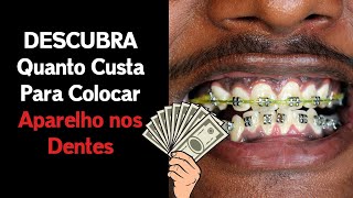 O Preço do Aparelho Ortodôntico Não é Baixo (+ de R$ 5000,00) - VALOR ATUALIZADO 2022