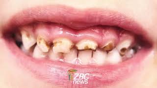 Bad eating habits creating a generation of rotten teeth