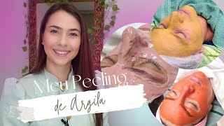 Peeling de Argila - Enriqueça seus tratamentos!