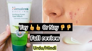Himalaya Purifying Neem Face Wash Honest Review || Urdu/Hindi