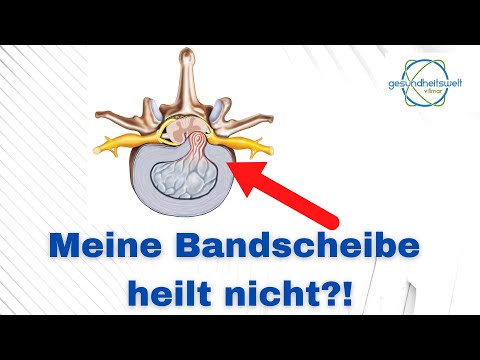 Warum heilt meine Bandscheibe nicht? Bandscheibenvorfall (LWS)