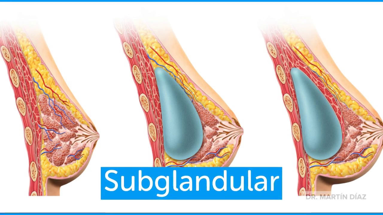 Marcos Martín Díaz-10