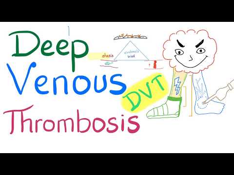 Deep Venous Thrombosis (DVT) - Causes, Symptoms, Signs, Diagnosis, and Treatment - Pulmonology