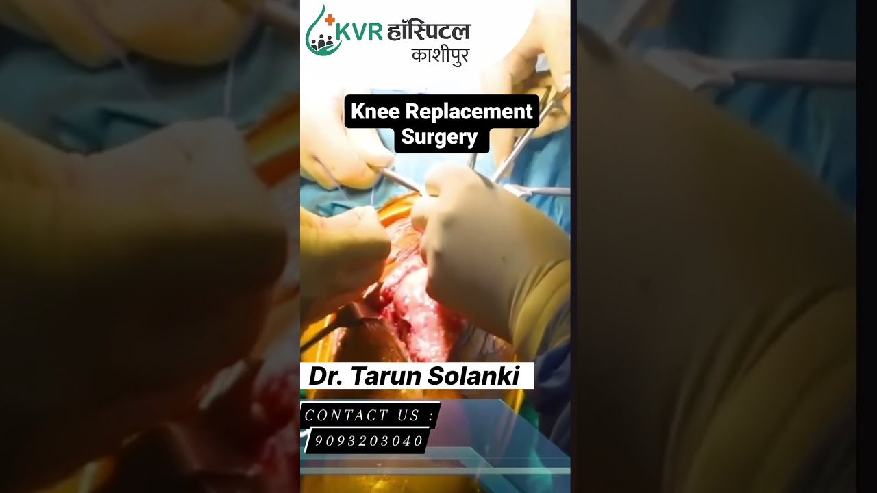 Knee Replacement Surgery #kneereplacementsurgery #drtarunsolanki #kvrhospitalkashipur