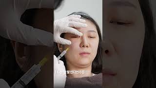 스컬트라 성형 시술