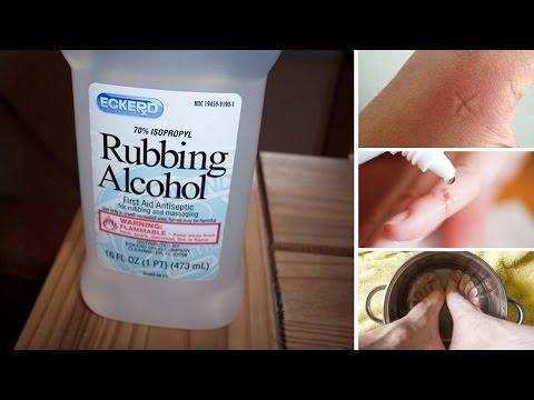 Amazing uses of rubbing alcohol