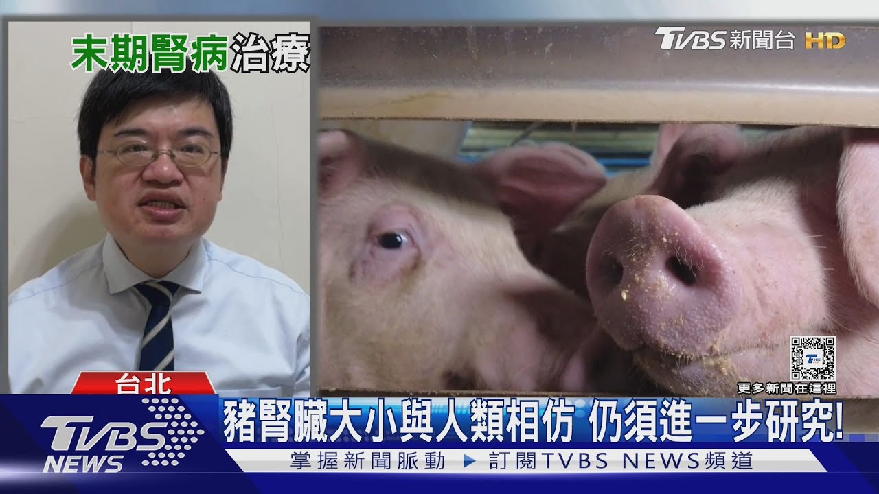 罹「這疾病 」....摘除「豬腎」器官移植...可延長生命?!