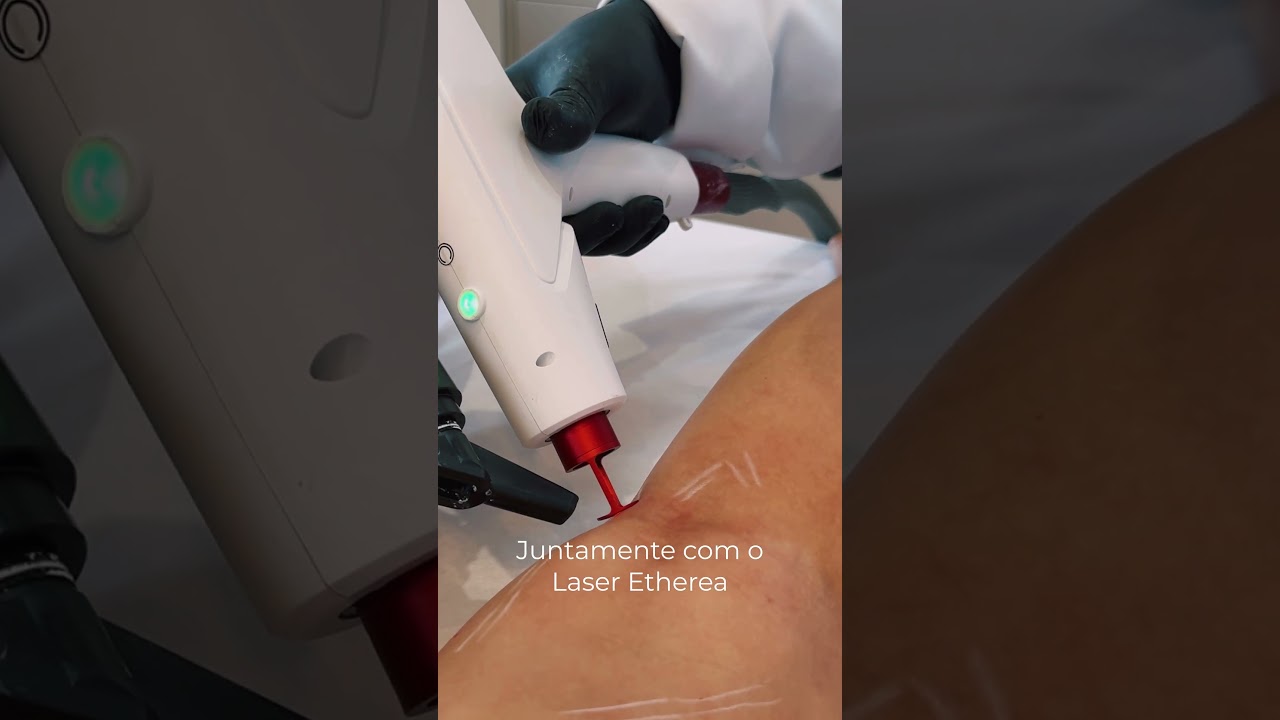 Adbeel Franco Barbosa-26