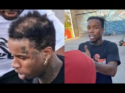 Tory Lanez Hair Line Falls Off At N.O.R.E Celebrity Basketball Tournament In Miami