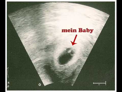Für unser Sternenkind Merle 2011