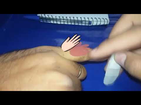 Curativo (Band Aid) que não sai do lugar e nova pulseira de paracord