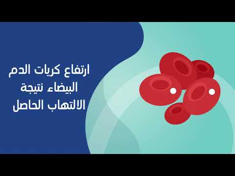 أعراض التهاب المرارة - فيديو
