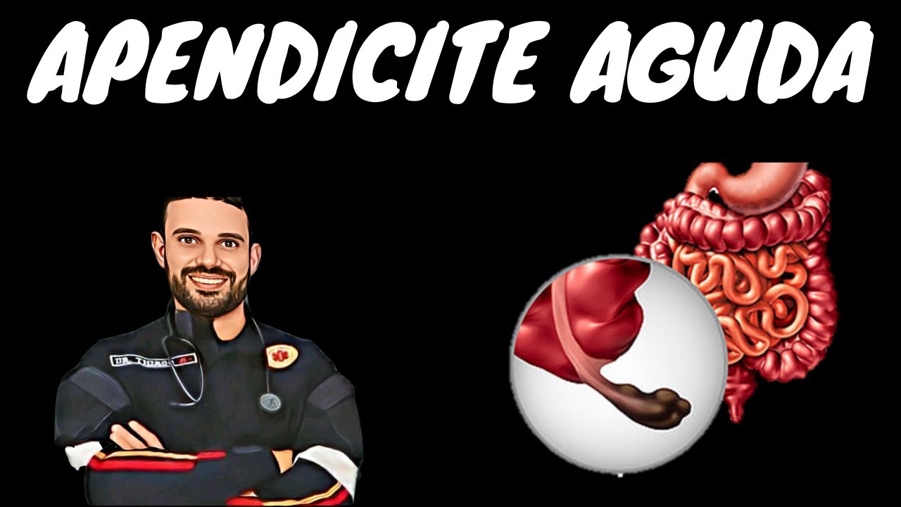 Apendicite Aguda - Aula Completa