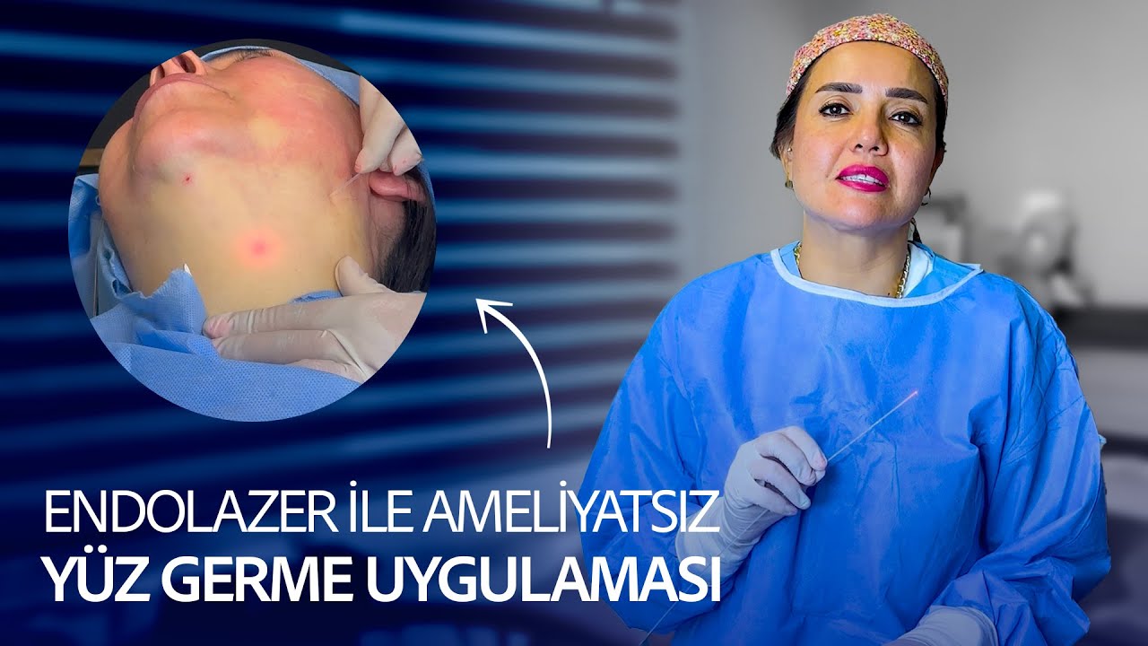ENDOLAZER İLE AMELİYATSIZ YÜZ GERME İŞLEMİ I YÜZ GERME UYGULAMASI