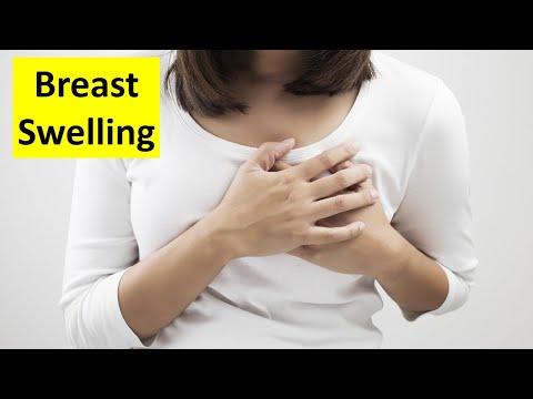 Breast Swelling-Differential Diagnosis (Fibroadenoma, Fibrocystic, Ca, Ectasia, Mastitis, Abscess)