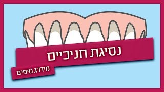 נסיגת חניכיים - מה גורם לזה ואיך מטפלים?
