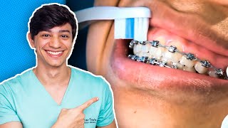 Como ESCOVAR os DENTES COM APARELHO corretamente. PASSO A PASSO !!