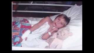 Hopes cleft journey updated version... (my daughter born with a cleft lip and palate)