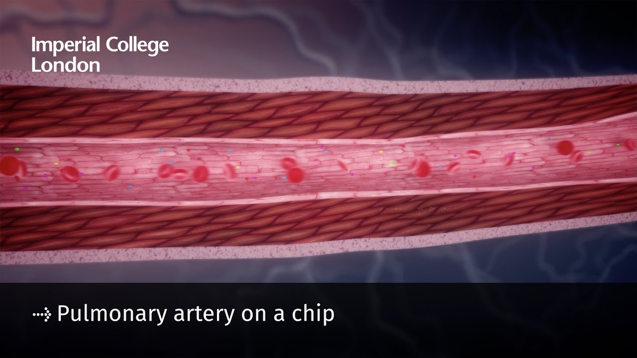 Pulmonary artery on a chip