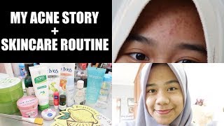 BRUNTUSAN HILANG CUMA PAKE SATU PRODUK?!! | MY ACNE STORY + SKINCARE ROUTINE
