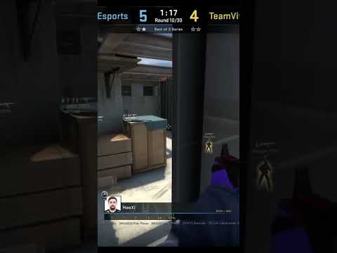 super smart vertigo ct setup