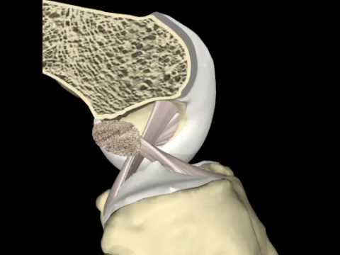 Perché male le costole con osteocondrosi Massaggio dellarticolazione della spalla in ambiente home video