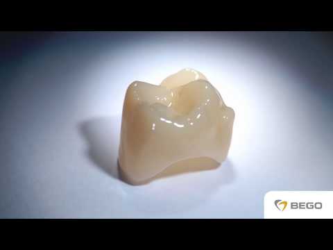 VarseoSmile Crown plus