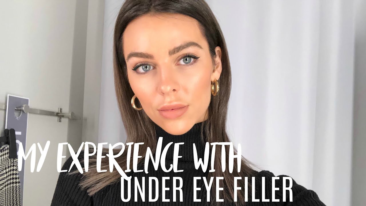 Under Eye Filler Injections | My experience + before and after