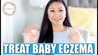 3 WAYS TO TREAT BABY ECZEMA! (It really works!)
