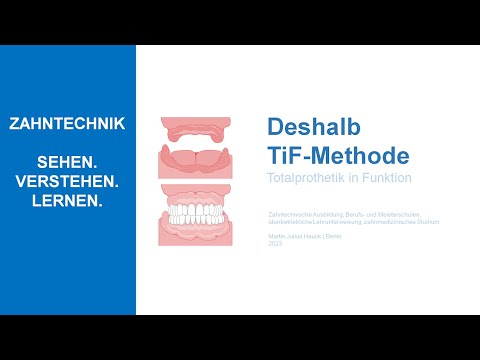 Deshalb TiF-Methode