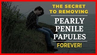 How To Get Rid Of Pearly Penile Papules Without Surgery | Some Serious Results!