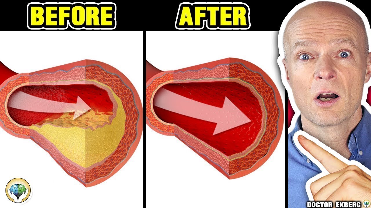 Watch video Only A Glass Of This Juice... Reverse Clogged Arteries & Lower High Blood Pressure - Doctor Reacts Now Only A Glass Of This Juice... Reverse Clogged Arteries & Lower High Blood Pressure - Doctor Reacts